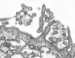 Transmission electron micrograph of Sin Nombre virus
