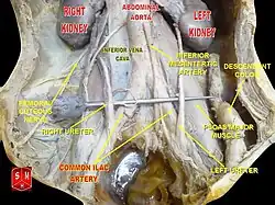 Abdominal aorta