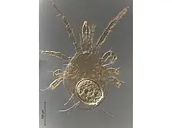 A microscope image of Amblyseius largoensis