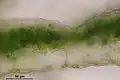 Conocephalum salebrosum, thallus cross section showing photosynthetic cells