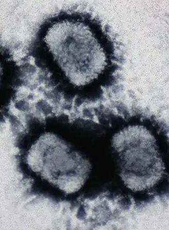 Electron micrograph of three Cowpox virus particles