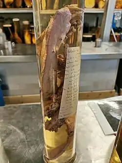 #487 (15/3/2004), Additional limb remains from the "Archie" specimen, stored in a separate vessel filled with 10% formol-saline, on display as part of the NHM's Spirit Collection Tour (see also specimen label)