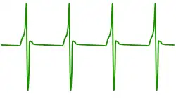 A gymnotiform electrolocation waveform