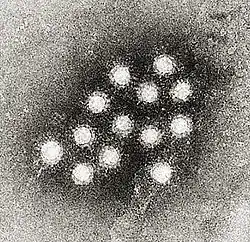 Electron micrograph of Hepatitis A virus virions