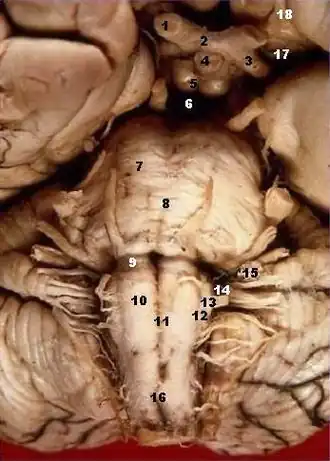 The hypoglossal nerve emerges as several rootlets (labelled here as number 12) from the olives of the medulla (labelled 13), part of the brainstem.