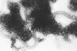 Transmission electron micrograph of Human orthopneumovirus