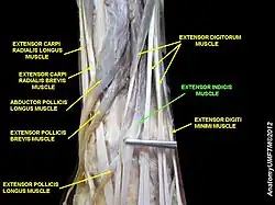 Extensor indicis muscle