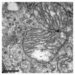 TEM image of mitochondria of a MEF cell. The cristae are visible as parallel tubular structures inside the mitochondria.