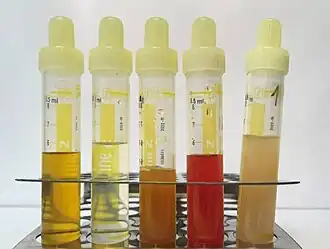 Five urine samples, ranging from clear and slightly yellow to opaque and red